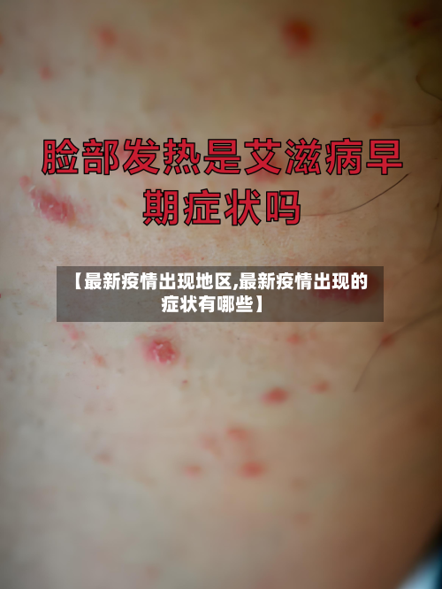 【最新疫情出现地区,最新疫情出现的症状有哪些】